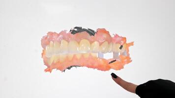 3D dental scan showing upper and lower jaw with implants and gums, Digital dentistry image displays gum tissue, teeth structure and restoration elements video