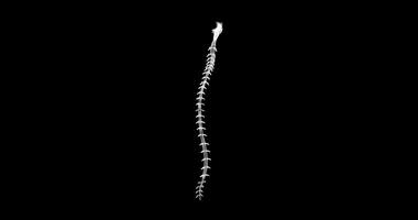Hologram representation screen 3d of the spinal cord in the human body - loop video