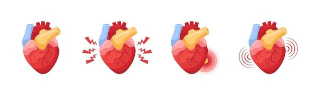 Heart animation showing different stages of pain from mild discomfort to severe vibrations vector
