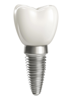 Realistic dental implant model isolated on transparent background png