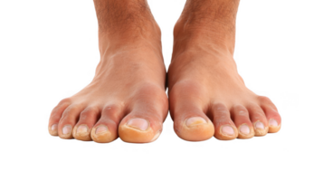 Man showing discolored toenails on transparent background png