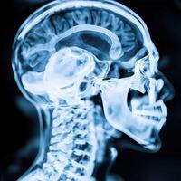 Understanding human anatomy through x ray imagery photo