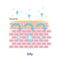 The mechanism of oily skin illustration on white background. Cross section of natural oil on skin layer acts as an occlusive that help trap in water and hydration, less trans epidermal water loss. vector