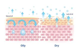 The mechanism of oily and dry skin illustration. Comparison of natural oil on skin layer acts as an occlusive, less transepidermal water loss. And lack of oil on skin causes more TEWL. vector