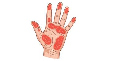 The Hand Body Map A Guide to Healing Through Hand Reflexology Techniques vector