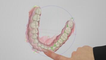 Digital Dental 3D Scan Visualization, Teeth Structure Displayed on Touchscreen video