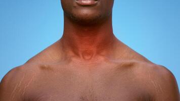 A young African American man with neck highlighted with red color in front of a clear blue backdrop. Guy suffering from sore throat video