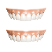 Before and After White Teeth for Dentist Advertisement on transparent background png