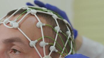 Detailed view of EEG net on forehead video