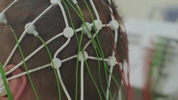 Sensor net on scalp during brain scan video