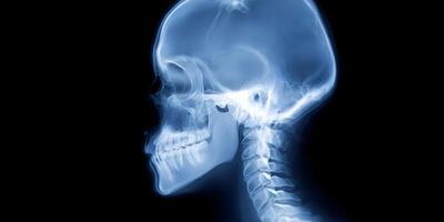 Human Skull XRay Side Profile Medical Image Anatomy photo