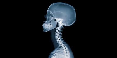 Human Skull and Cervical Spine XRay Side Profile photo