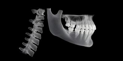 3D Render of Human Jawbone and Cervical Spine XRay Style Image photo
