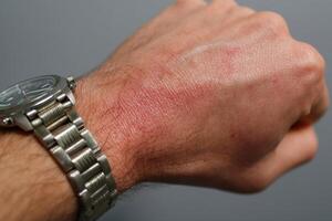 A man with a watch on his wrist photo