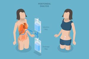 3D Isometric Flat Conceptual Illustration of Peritoneal Dialysis, Explanation Diagram vector