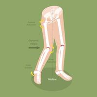 3D Isometric Flat Conceptual Illustration of Mechanism Of Acl Injury, Labeled Educational Diagram vector