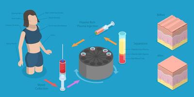 Platelet rich plasma injection process infographic vector