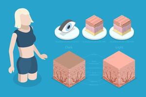 3D Isometric Flat Conceptual Illustration of Albinism, Compared Normal Skin Cross Section with Lack of Melanocyte vector
