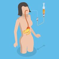3D Isometric Flat Conceptual Illustration of PEG, Nasogastric Tube Passed Through the Nose to Stomach vector