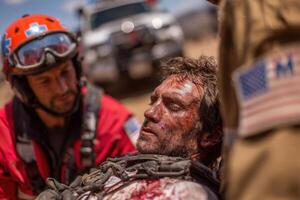 A man with blood on his face is being treated by an emergency worker photo
