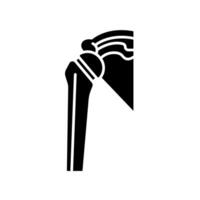Artificial joint black glyph icon for digital and print projects. vector