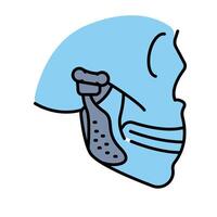 jaw prosthesis color flat icon for digital and print projects. vector