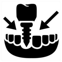 Tooth Transplantation icon concept in black color vector