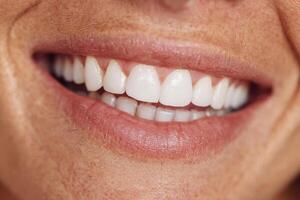 A joyful smile reveals a set of straight, white teeth, highlighting a sense of happiness and good dental care under natural light photo