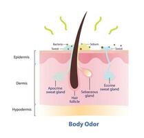 The mechanism of body odor illustration. The body odor is caused by a mix of bacteria and sweat on skin surface. Cross section of hair follicle, eccrine and apocrine sweat gland, produce body odor. vector