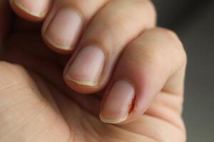 Close-up of a woman's hand nails without manicure. Clean hands photo