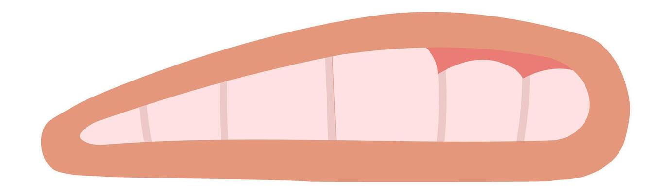 Gums covering teeth display signs of gingivitis, a prevalent gum disease characterized by swollen, red gums that bleed easily and indicate potential oral health issues