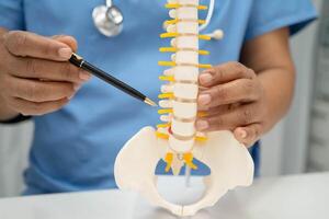 spinal nerve bone model, Lumbar spine displaced herniated disc fragment photo