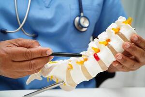 lumbar vertebra bone skeleton and nerve model for treatment in the orthopedic department. photo