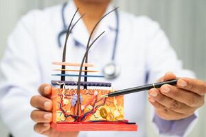 Hair transplant dermatologist doctor holding skin structure photo