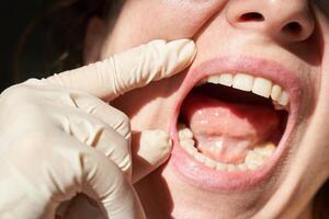 Female dentist examining open mouth with gloved hands highlighting healthy teeth and gums in close-up view. photo