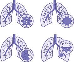 Colored Icons of Lung Disease, Bronchitis, COPD, and Pneumonia. Icons of Various Lung Diseases. Healthcare and Medicine vector