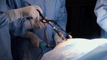 Professional medical team in sterile surgical attire meticulously performs a laparoscopic procedure, utilizing advanced instruments and techniques to ensure patient safety and successful outcome video