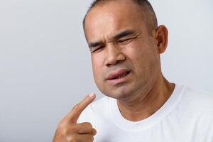 Man facial swelling due to an allergic reaction to triggers such as insect bites, food photo