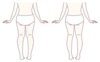 A Detailed Comparison of Leg Shapes Analyzing Before and After Transformational Changes vector