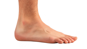 Swollen foot showing signs of inflammation on transparent background png