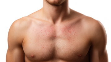 Man showing skin allergy symptoms on chest on transparent background png