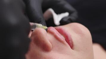 Close-up of a specialist giving a lip injection to a young woman. Lip augmentation and correction procedure. Cosmetology concept. video