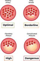 Progression of Artery Health From Optimal to Dangerous Conditions Illustration vector