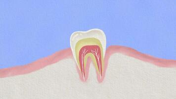 a tooth with a root and a root canal video