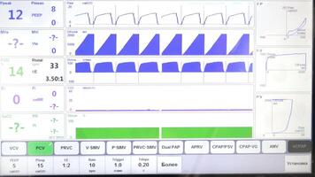 Advanced Respiratory Monitoring Interface, Mechanical Ventilation Data Displayed on Medical Screen video
