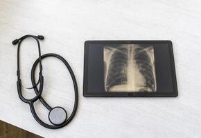 Table with phonendoscope, and a X ray image of the lungs with pneumonia on the tablet. Healthcare photo