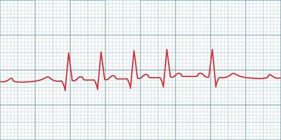 Medical heart rate monitoring displayed on an ECG or EKG graph with a clear pulse line. vector