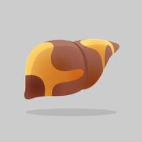 Cartoon concept for hepatic steatosis disease vector