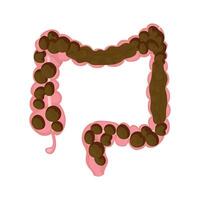 Medical illustration showing intestines filled with hard, dry stool, illustrating the abdominal pain and discomfort associated with constipation and digestive health challenges vector