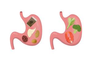 Healthy and unhealthy food comparing good and bad nutrition for stomach and gut showing vegetables, fish and chips, coffee, salami with digestive problems concept vector